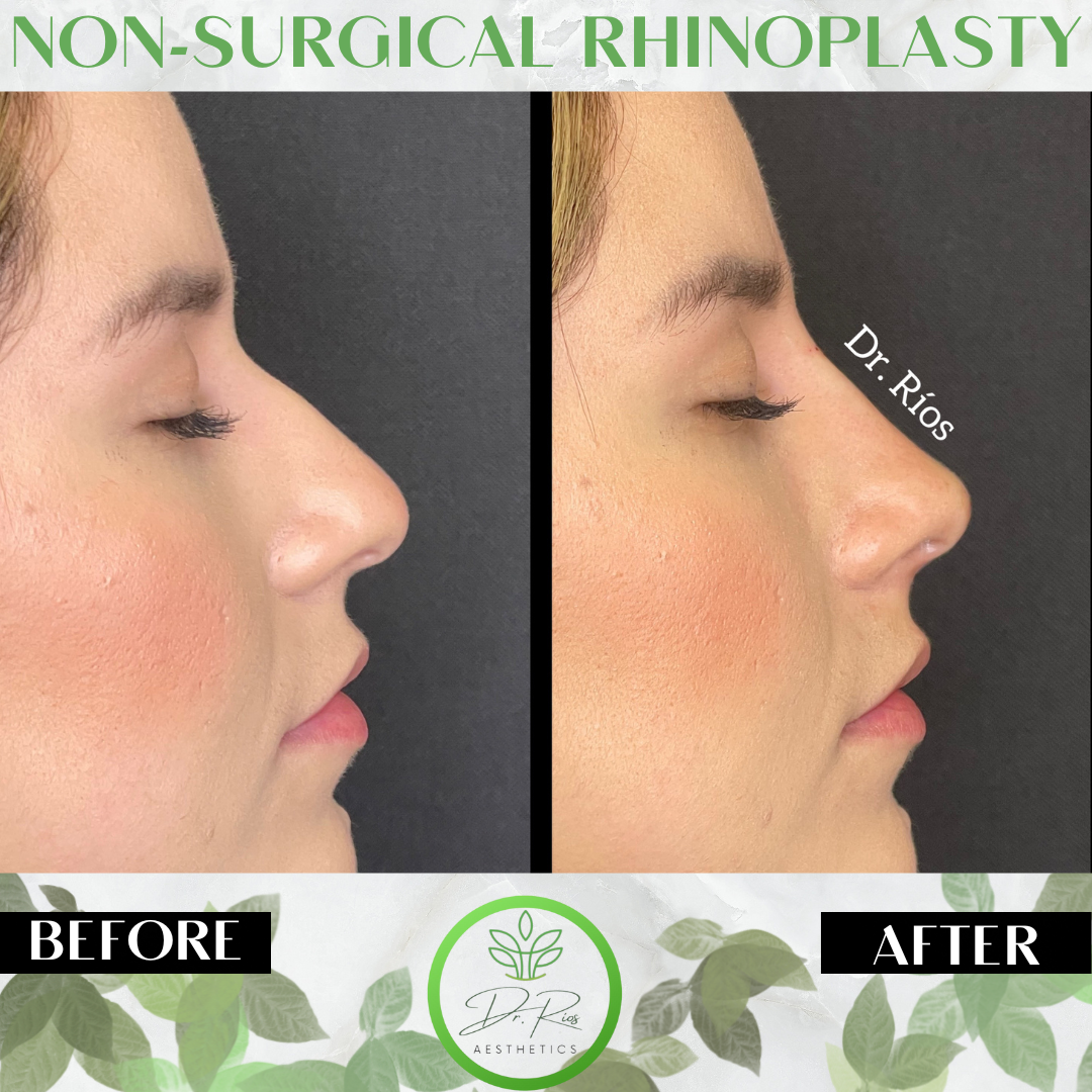 Dr.Rios Aesthetics – Líderes en tratamientos estéticos de alta calidad