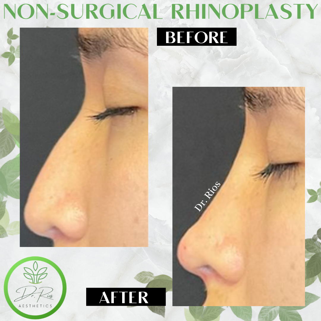 Dr.Rios Aesthetics – Líderes en tratamientos estéticos de alta calidad